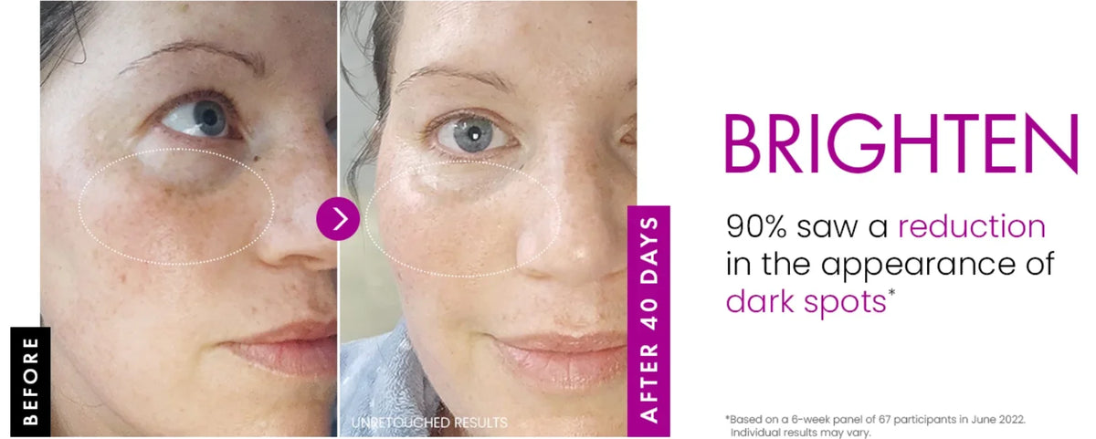 Collagen Day & Night Moisturizer