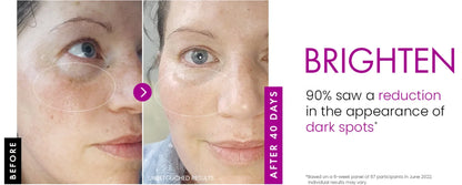 Collagen Day & Night Moisturizer