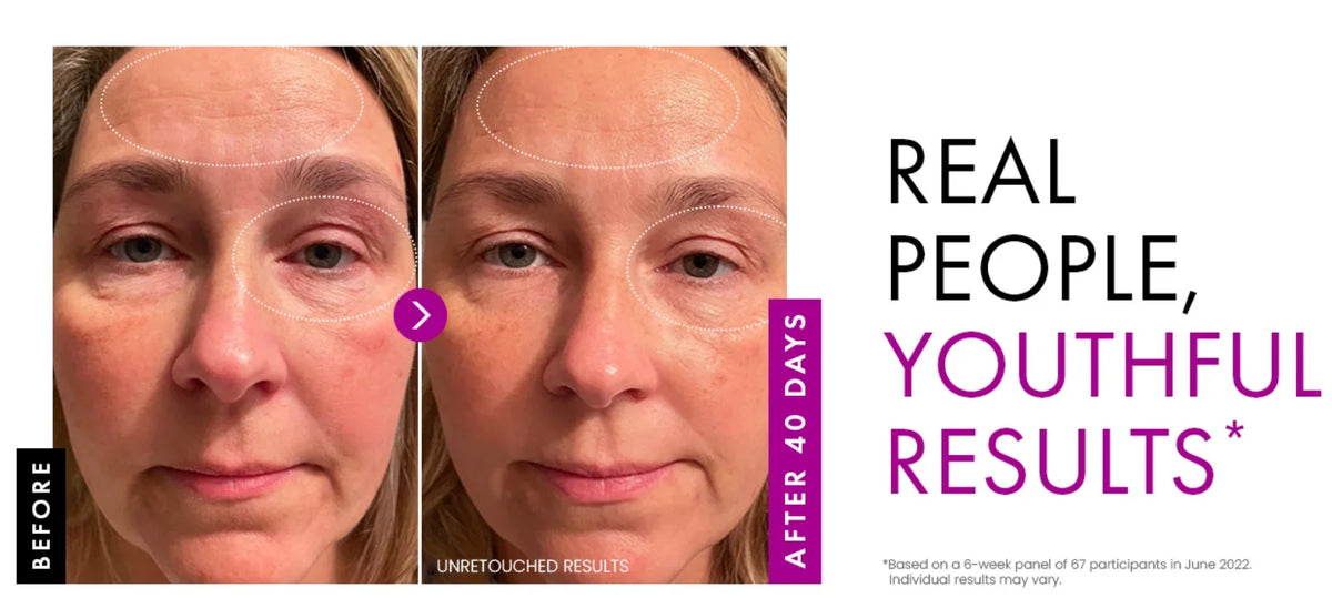 Collagen Day & Night Moisturizer